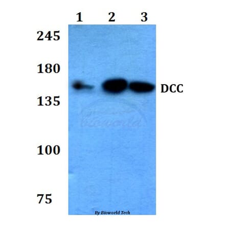 Anti-DCC (F465) Antibody from Bioworld Technology (BS3232) - Antibodies.com
