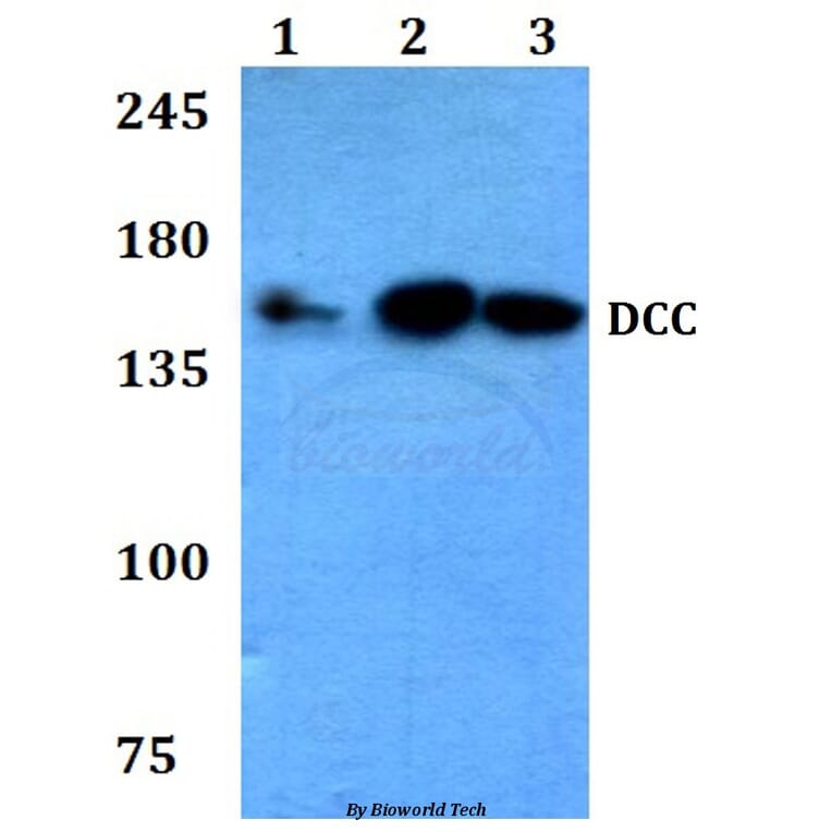 Anti-DCC (F465) Antibody from Bioworld Technology (BS3232) - Antibodies.com