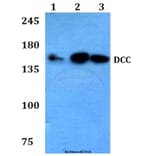 Anti-DCC (F465) Antibody from Bioworld Technology (BS3232) - Antibodies.com