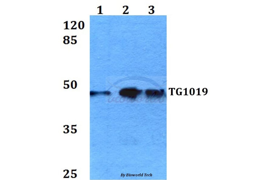 Anti-TG1019 (R251) Antibody from Bioworld Technology (BS3237) - Antibodies.com