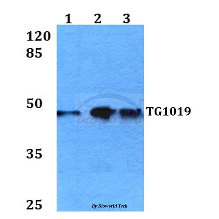 Anti-TG1019 (R251) Antibody from Bioworld Technology (BS3237) - Antibodies.com
