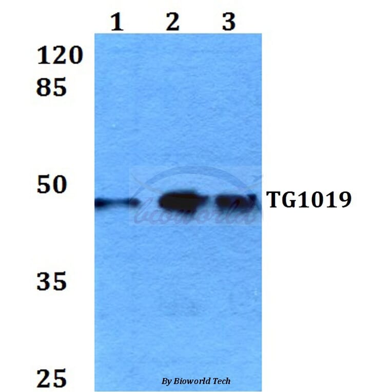 Anti-TG1019 (R251) Antibody from Bioworld Technology (BS3237) - Antibodies.com