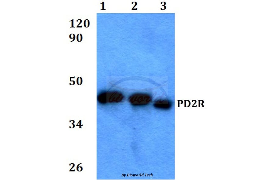 Anti-PD2R (E301) Antibody from Bioworld Technology (BS3239) - Antibodies.com