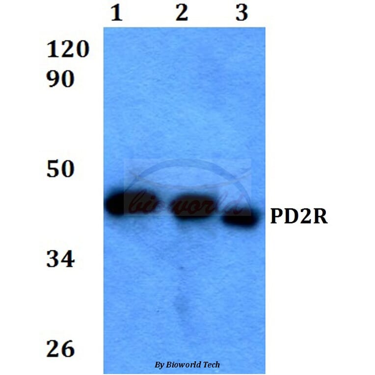 Anti-PD2R (E301) Antibody from Bioworld Technology (BS3239) - Antibodies.com