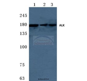 Anti-ALK (W1503) Antibody from Bioworld Technology (BS3243) - Antibodies.com