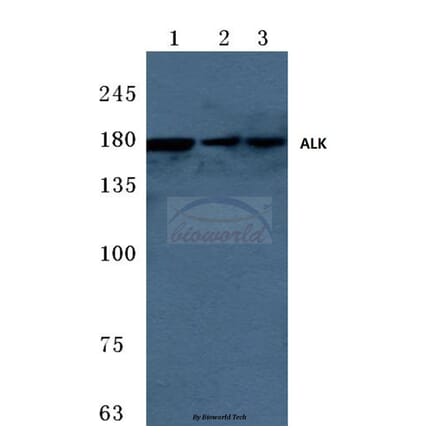 Anti-ALK (W1503) Antibody from Bioworld Technology (BS3243) - Antibodies.com