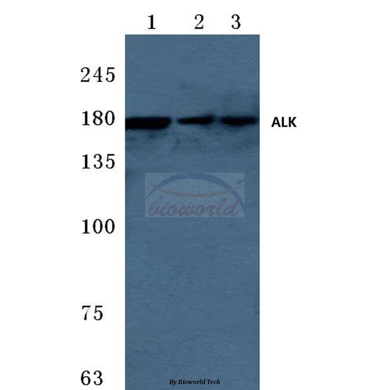 Anti-ALK (W1503) Antibody from Bioworld Technology (BS3243) - Antibodies.com