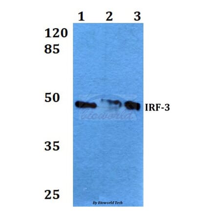 Anti-IRF-3 (V391) Antibody from Bioworld Technology (BS3244) - Antibodies.com
