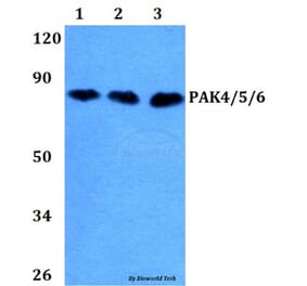 Anti-PAK4/5/6 (V469) Antibody from Bioworld Technology (BS3247) - Antibodies.com