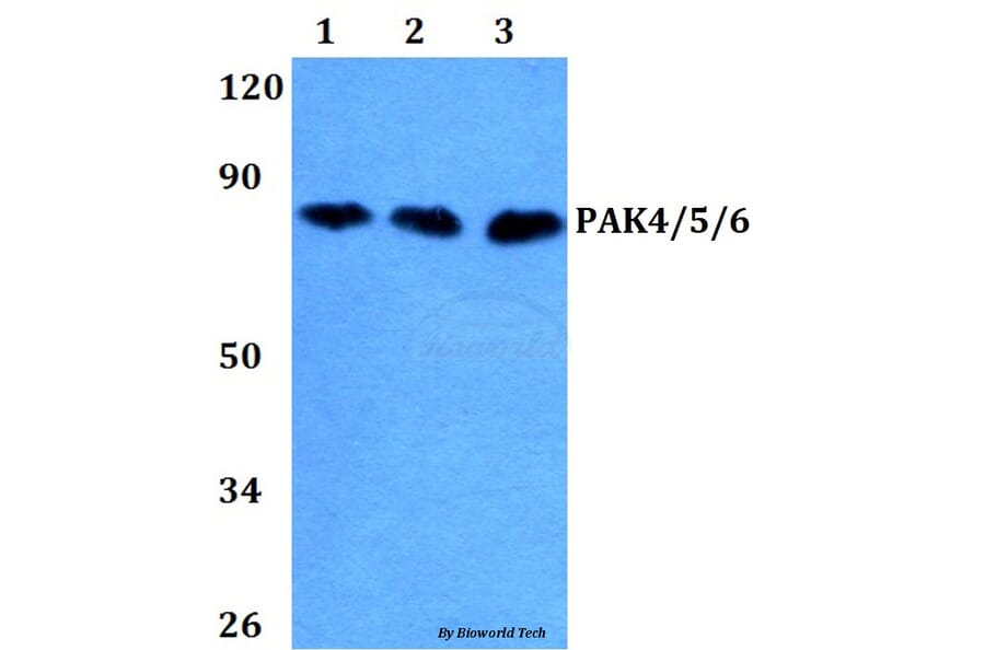 Anti-PAK4/5/6 (V469) Antibody from Bioworld Technology (BS3247) - Antibodies.com