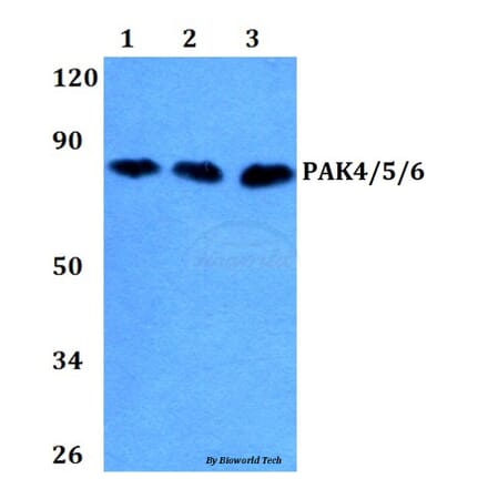 Anti-PAK4/5/6 (V469) Antibody from Bioworld Technology (BS3247) - Antibodies.com