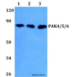 Anti-PAK4/5/6 (V469) Antibody from Bioworld Technology (BS3247) - Antibodies.com