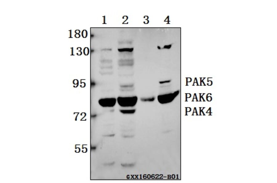 Anti-PAK4/5/6 (V469) Antibody from Bioworld Technology (BS3247) - Antibodies.com