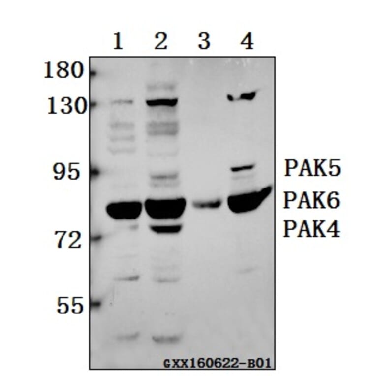 Anti-PAK4/5/6 (V469) Antibody from Bioworld Technology (BS3247) - Antibodies.com