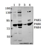 Anti-PAK4/5/6 (V469) Antibody from Bioworld Technology (BS3247) - Antibodies.com
