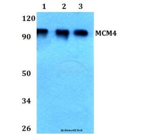 Anti-MCM4 (P50) Antibody from Bioworld Technology (BS3249) - Antibodies.com
