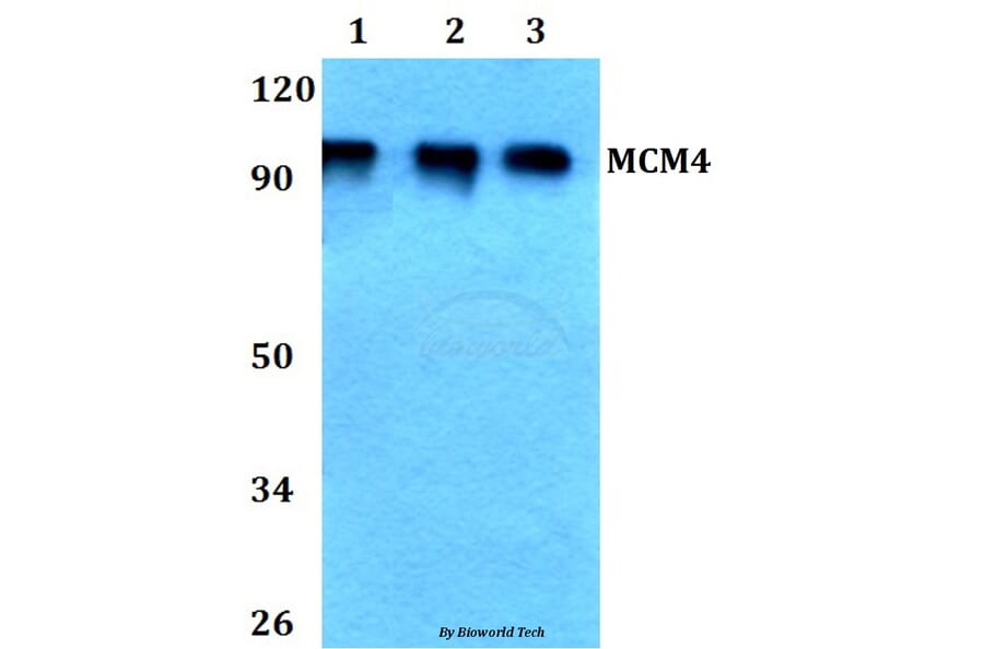 Anti-MCM4 (P50) Antibody from Bioworld Technology (BS3249) - Antibodies.com