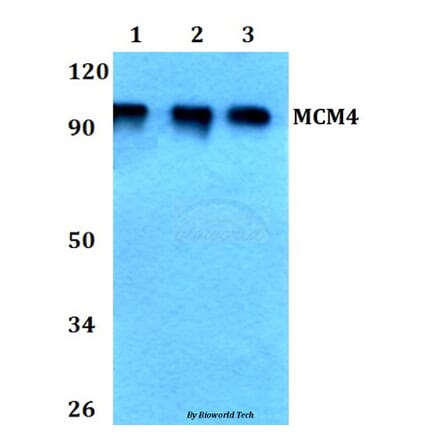 Anti-MCM4 (P50) Antibody from Bioworld Technology (BS3249) - Antibodies.com