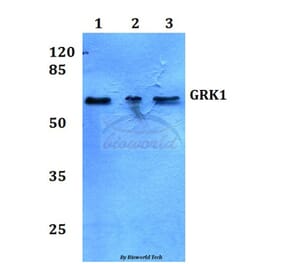 Anti-GRK1 (A17) Antibody from Bioworld Technology (BS3251) - Antibodies.com