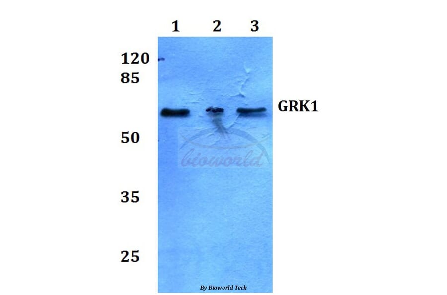 Anti-GRK1 (A17) Antibody from Bioworld Technology (BS3251) - Antibodies.com