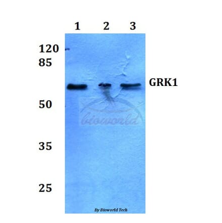 Anti-GRK1 (A17) Antibody from Bioworld Technology (BS3251) - Antibodies.com