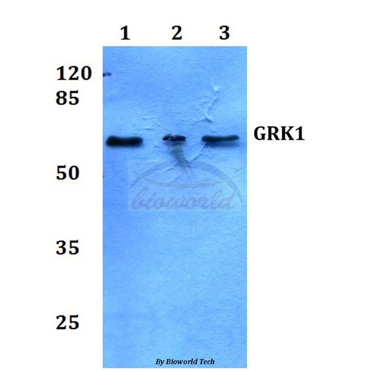 Anti-GRK1 (A17) Antibody from Bioworld Technology (BS3251) - Antibodies.com