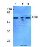 Anti-GRK1 (A17) Antibody from Bioworld Technology (BS3251) - Antibodies.com