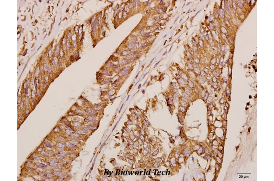 Anti-GRK1 (A17) Antibody from Bioworld Technology (BS3251) - Antibodies.com
