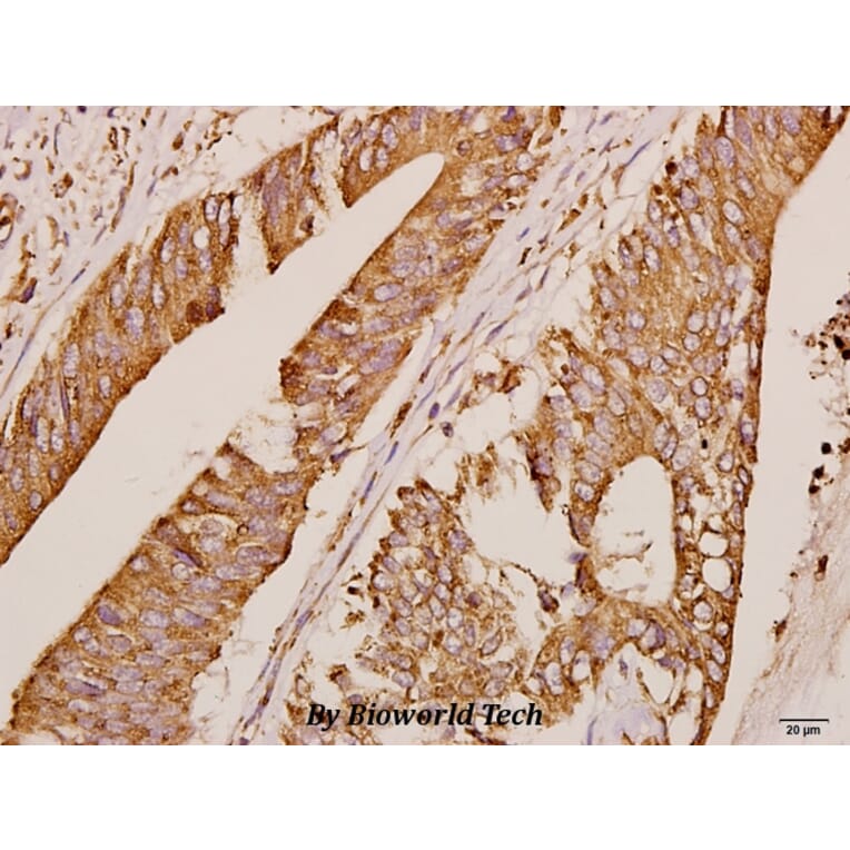 Anti-GRK1 (A17) Antibody from Bioworld Technology (BS3251) - Antibodies.com