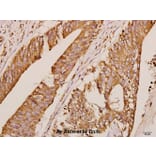 Anti-GRK1 (A17) Antibody from Bioworld Technology (BS3251) - Antibodies.com