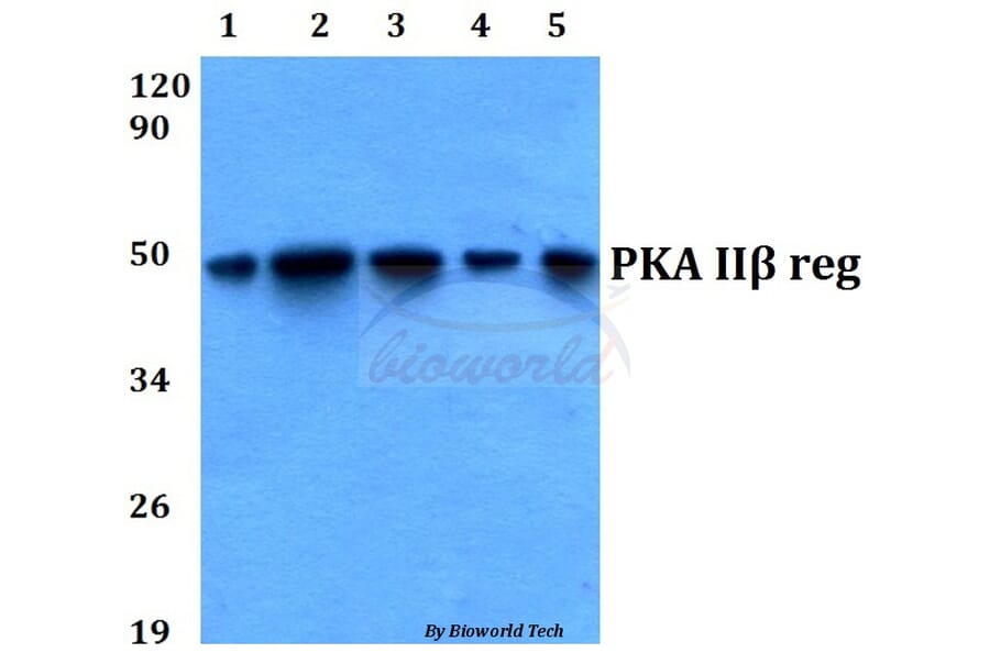 Anti-PKA IIβ reg (T109) Antibody from Bioworld Technology (BS3253) - Antibodies.com
