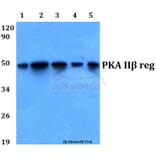 Anti-PKA IIβ reg (T109) Antibody from Bioworld Technology (BS3253) - Antibodies.com