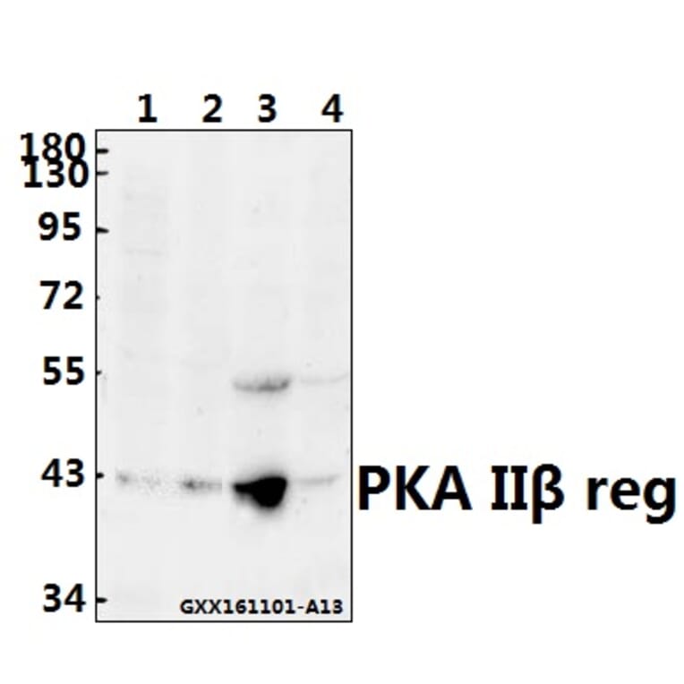 Anti-PKA IIβ reg (T109) Antibody from Bioworld Technology (BS3253) - Antibodies.com
