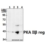 Anti-PKA IIβ reg (T109) Antibody from Bioworld Technology (BS3253) - Antibodies.com