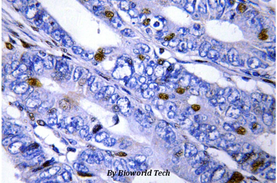 Anti-PKA IIβ reg (T109) Antibody from Bioworld Technology (BS3253) - Antibodies.com