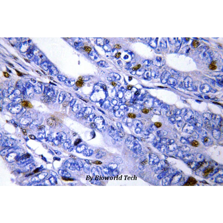 Anti-PKA IIβ reg (T109) Antibody from Bioworld Technology (BS3253) - Antibodies.com