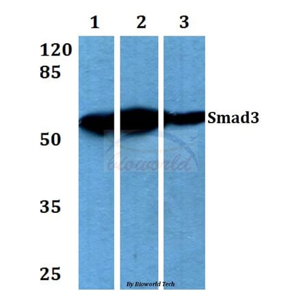 Anti-Smad3 (M200) Antibody from Bioworld Technology (BS3255) - Antibodies.com