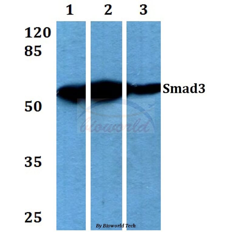 Anti-Smad3 (M200) Antibody from Bioworld Technology (BS3255) - Antibodies.com
