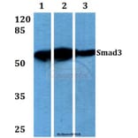 Anti-Smad3 (M200) Antibody from Bioworld Technology (BS3255) - Antibodies.com