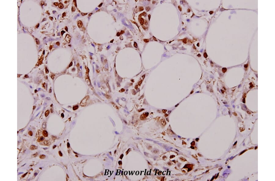 Anti-Smad3 (M200) Antibody from Bioworld Technology (BS3255) - Antibodies.com