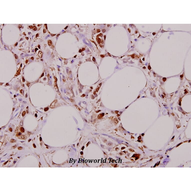Anti-Smad3 (M200) Antibody from Bioworld Technology (BS3255) - Antibodies.com
