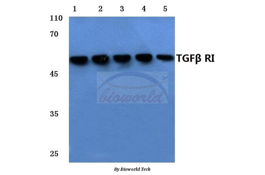 Anti-TGFβ RI (E161) Antibody from Bioworld Technology (BS3257) - Antibodies.com