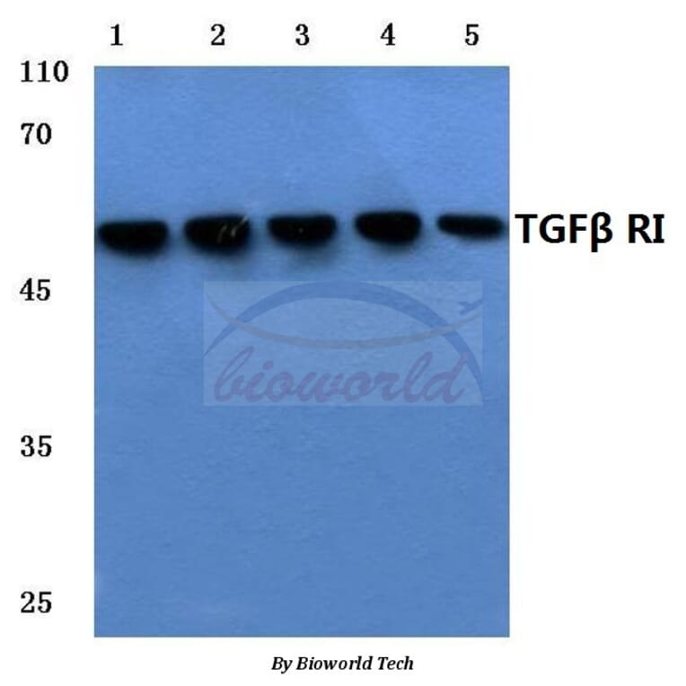 Anti-TGFβ RI (E161) Antibody from Bioworld Technology (BS3257) - Antibodies.com