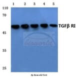 Anti-TGFβ RI (E161) Antibody from Bioworld Technology (BS3257) - Antibodies.com