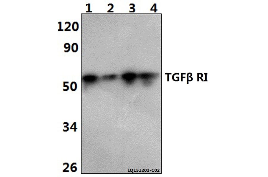 Anti-TGFβ RI (E161) Antibody from Bioworld Technology (BS3257) - Antibodies.com