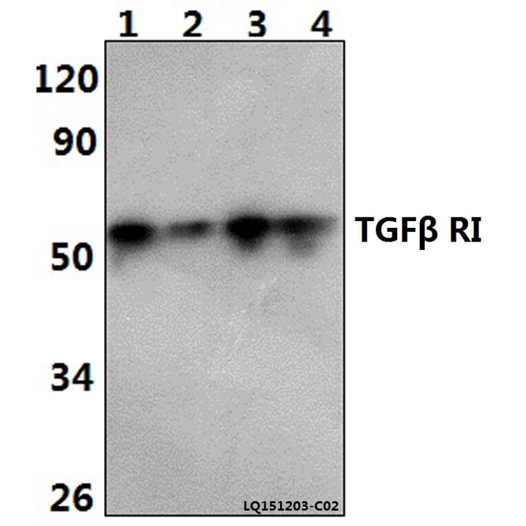Anti-TGFβ RI (E161) Antibody from Bioworld Technology (BS3257) - Antibodies.com