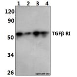 Anti-TGFβ RI (E161) Antibody from Bioworld Technology (BS3257) - Antibodies.com