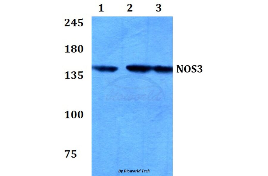 Anti-NOS3 (I611) Antibody from Bioworld Technology (BS3259) - Antibodies.com