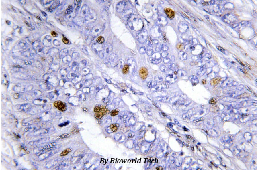Anti-Nur77/NR4A1 (G347) Antibody from Bioworld Technology (BS3260) - Antibodies.com