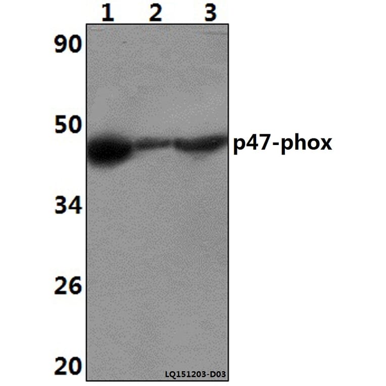 Anti-p47-phox (P366) Antibody from Bioworld Technology (BS3261) - Antibodies.com